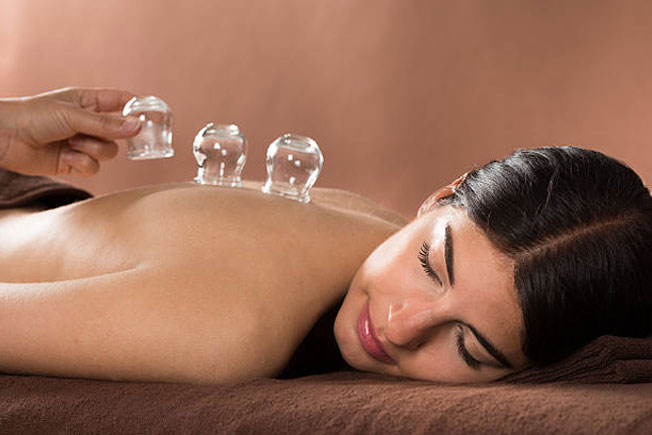 Cupping Therapy in Mississauga