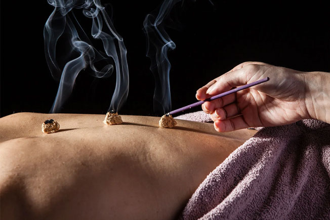 Moxibustion Therapy in Mississauga