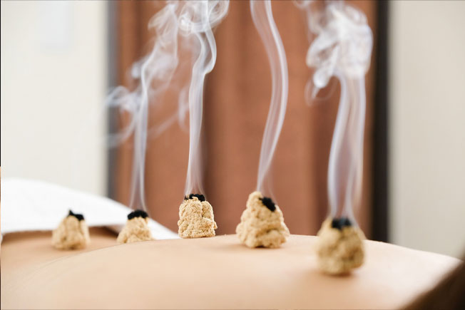 Moxibustion Therapy in Mississauga