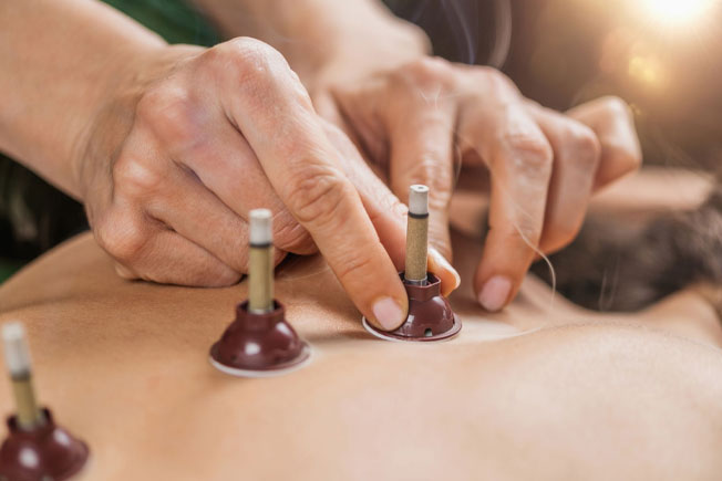 Moxibustion Therapy in Mississauga