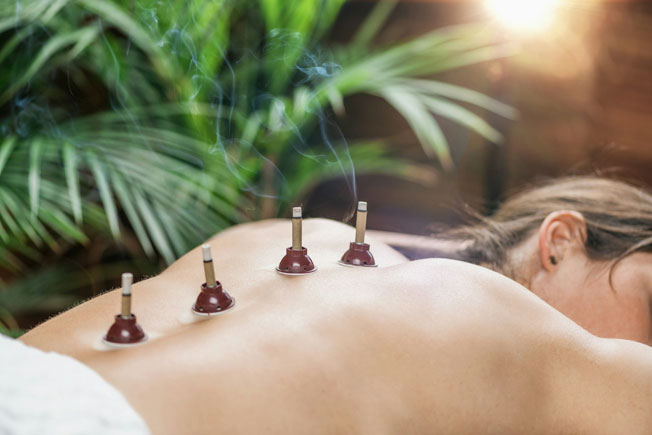 Moxibustion Therapy in Mississauga